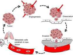 Malignant Neoplasm Adalah Kanker: Pengertian Lengkap