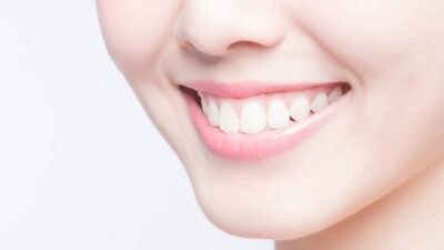 Cara Memutihkan Gigi Secara Alami yang Aman dan Efektif