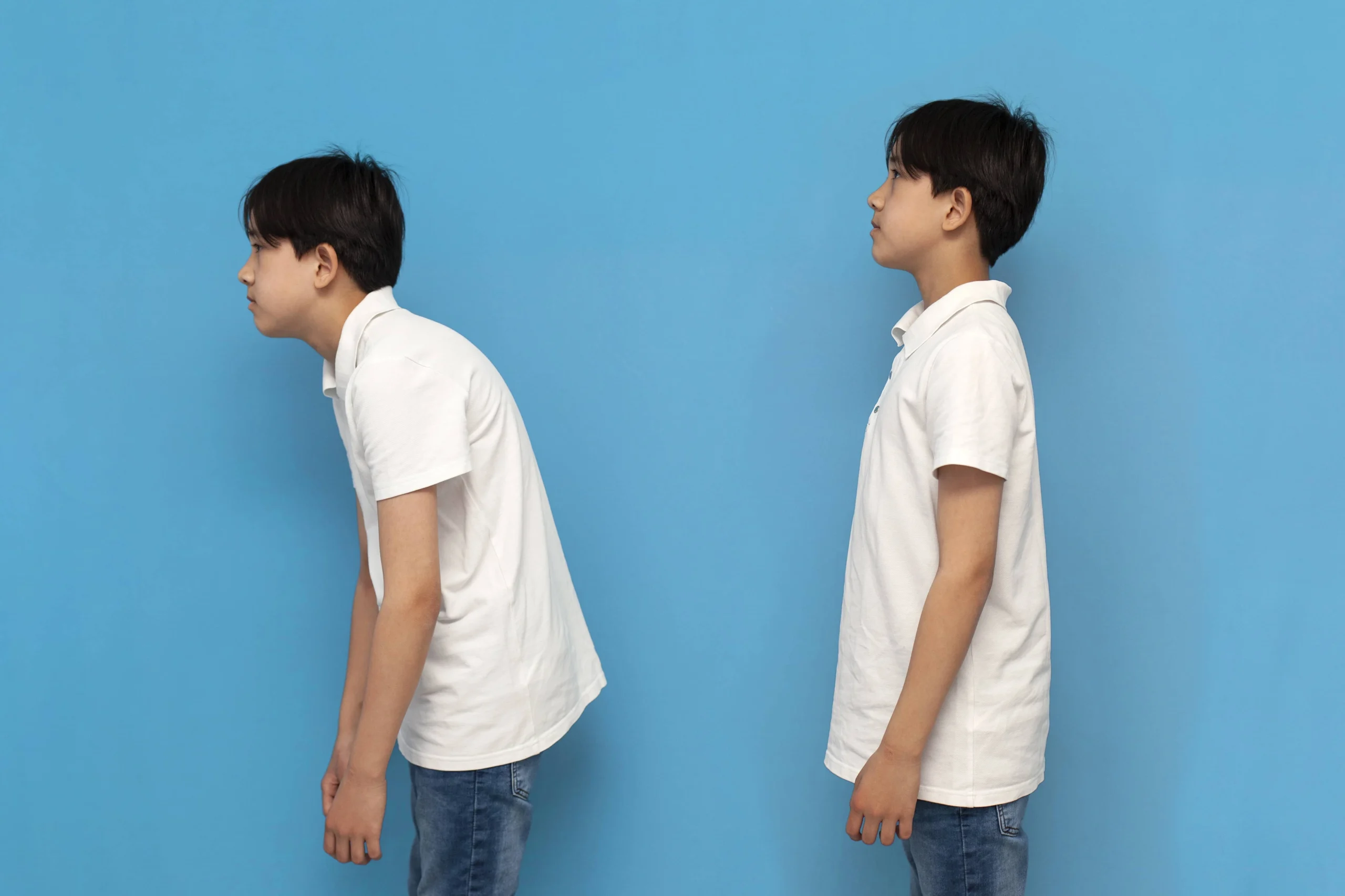 Awas Jadi "Udang Rebus"! Kenali Bahaya Postur Bungkuk yang Sering Kita Abaikan - BCA Life